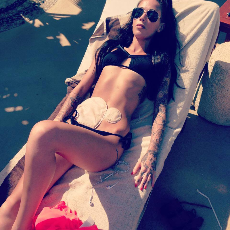 Illustration for article titled Woman Living With Crohn's and Colostomy Bag Pursues Modeling Career